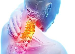 Osteokonondrosaren cervikalaren arrazoiak